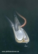 Herz01
